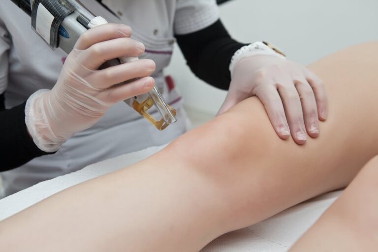 What to Know Before Your Laser Hair Removal at 413 Medical